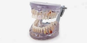 P12D-100M Pathologisches Studienmodell OK + UK, transparent