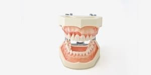 P15D-162H1 Parodontiemodell mit weicher, transparenter Gingiva (rosa)