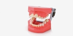 P4D-407F OK + UK Überbiss Demonstrations-Modellpaar