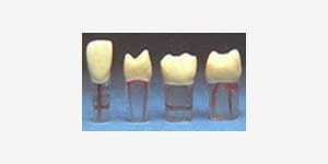 S12H-500 Zahn mit transparenter Wurzel (10 Stk.)