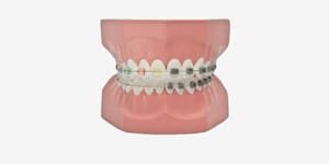 P3B-706 Kieferorthopädisches Zahnputzmodell (28 Zähne)