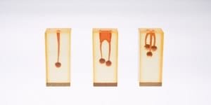 S6-U1 Wurzelkanalmodell mit Blase, gefärbt