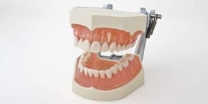 i21D-400C Modell OK + UK mit anatomischen Zähnen, herausnehmbar