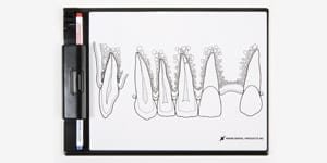 P13-TR200A Demonstrationstafel Frontzahnbereich