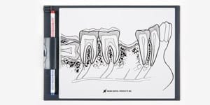P13-TR200 Demonstrationstafel Seitenzahnbereich