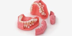 Zahnfleisch für P1-600C, Wachstumsmodell OK