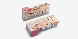 P13-TR9 2-teiliges Molarmodell, 2,5-fach vergrößert