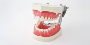 i2D-400C Modell OK + UK mit anatomischen Zähnen, herausnehmbar