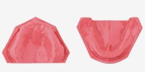 G1-402B U + L, besteht aus 8366-100+8366-200